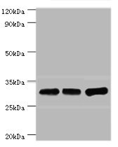 HnRNP A0 Antibody - Western blot All lanes: HNRNPA0 antibody at 12µg/ml Lane 1: Mouse brain tissue Lane 2: Hela whole cell lysate Lane 3: Jurkat whole cell lysate Secondary Goat polyclonal to rabbit IgG at 1/10000 dilution Predicted band size: 31 kDa Observed band size: 31 kDa