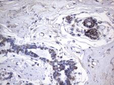 HnRNP A0 Antibody - Immunohistochemical staining of paraffin-embedded Human breast tissue within the normal limits using anti-HNRNPA0 mouse monoclonal antibody. (Heat-induced epitope retrieval by 1mM EDTA in 10mM Tris buffer. (pH8.5) at 120°C for 3 min. (1:150)