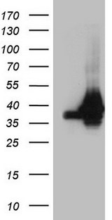 HnRNP A0 Antibody - HEK293T cells were transfected with the pCMV6-ENTRY control. (Left lane) or pCMV6-ENTRY HNRNPA0. (Right lane) cDNA for 48 hrs and lysed. Equivalent amounts of cell lysates. (5 ug per lane) were separated by SDS-PAGE and immunoblotted with anti-HNRNPA0. (1:2000)