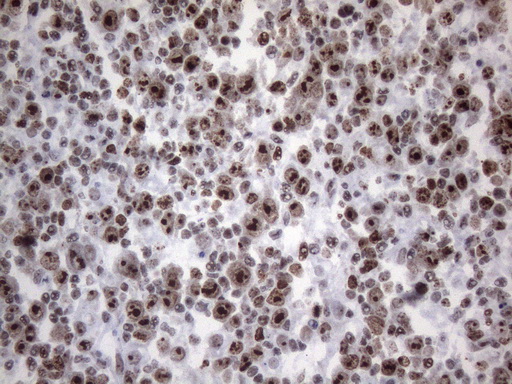 HnRNP A0 Antibody - Immunohistochemical staining of paraffin-embedded Human lymph node tissue within the normal limits using anti-HNRNPA0 mouse monoclonal antibody. (Heat-induced epitope retrieval by 1mM EDTA in 10mM Tris buffer. (pH8.5) at 120°C for 3 min. (1:150)