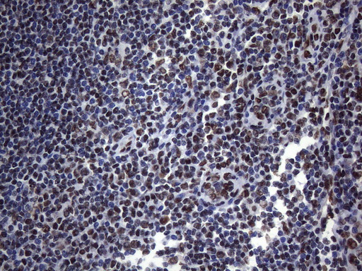 HnRNP A0 Antibody - Immunohistochemical staining of paraffin-embedded Human tonsil within the normal limits using anti-HNRNPA0 mouse monoclonal antibody. (Heat-induced epitope retrieval by 1mM EDTA in 10mM Tris buffer. (pH8.5) at 120°C for 3 min. (1:150)