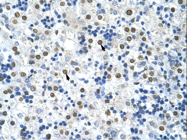 HnRNP A0 Antibody - HNRNPA0 / HNRPA0 antibody ARP40686_T100-NP_006796-HNRPA0 (heterogeneous nuclear ribonucleoprotein A0) Antibody was used in IHC to stain formalin-fixed, paraffin-embedded human liver.  This image was taken for the unconjugated form of this product. Other forms have not been tested.