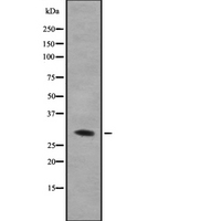 HnRNP A0 Antibody - Western blot analysis of hnRNP A0 using COLO205 whole cells lysates