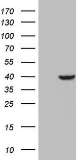 HnRNP-E1 / PCBP1 Antibody - HEK293T cells were transfected with the pCMV6-ENTRY control (Left lane) or pCMV6-ENTRY PCBP1 (Right lane) cDNA for 48 hrs and lysed. Equivalent amounts of cell lysates (5 ug per lane) were separated by SDS-PAGE and immunoblotted with anti-PCBP1.