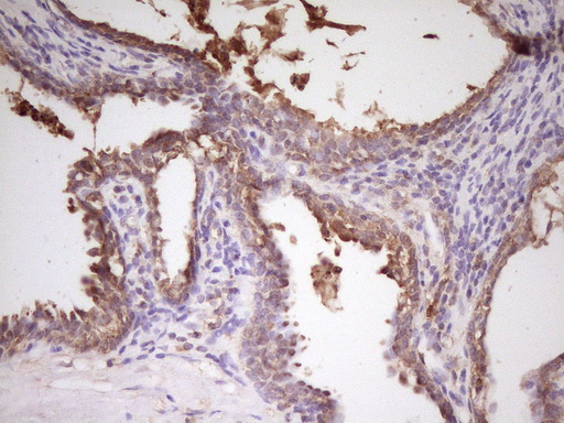 HnRNP-E1 / PCBP1 Antibody - Immunohistochemical staining of paraffin-embedded Human prostate tissue within the normal limits using anti-PCBP1 mouse monoclonal antibody. (Heat-induced epitope retrieval by 1 mM EDTA in 10mM Tris, pH8.5, 120C for 3min,