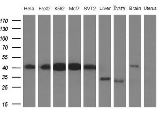 HnRNP-E1 / PCBP1 Antibody - Western blot analysis of extracts. (10ug) from 5 different cell lines and 4 human tissue by using anti-PCBP1 monoclonal antibody. (1: Hela; 2: HepG2; 3: K562; 4: Mcf7; 5: SVT2; 6: Liver; 7: Testis; 8: Brain; 9: Uterus)at 1:200 dilution.