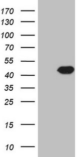 HnRNP-E1 / PCBP1 Antibody - HEK293T cells were transfected with the pCMV6-ENTRY control (Left lane) or pCMV6-ENTRY PCBP1 (Right lane) cDNA for 48 hrs and lysed. Equivalent amounts of cell lysates (5 ug per lane) were separated by SDS-PAGE and immunoblotted with anti-PCBP1.