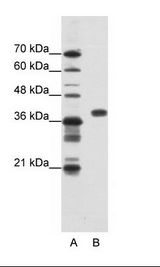 HnRNP-E1 / PCBP1 Antibody - A: Marker, B: HepG2 Cell Lysate.  This image was taken for the unconjugated form of this product. Other forms have not been tested.