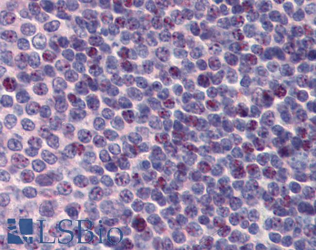 HnRNP-E1 / PCBP1 Antibody - Anti-PCBP1 antibody IHC of human spleen. Immunohistochemistry of formalin-fixed, paraffin-embedded tissue after heat-induced antigen retrieval. Antibody concentration 5 ug/ml.  This image was taken for the unconjugated form of this product. Other forms have not been tested.