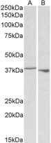HnRNP-E1 / PCBP1 Antibody - Goat Anti-PCBP1 (aa223-234) Antibody (0.1µg/ml) staining of Rat Spleen (A) and Thymus (B) lysate (35µg protein in RIPA buffer). Primary incubation was 1 hour. Detected by chemiluminescencence.