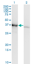 HnRNP-E1 / PCBP1 Antibody - Western Blot analysis of PCBP1 expression in transfected 293T cell line by PCBP1 monoclonal antibody (M01), clone 1G2.Lane 1: PCBP1 transfected lysate(37.5 KDa).Lane 2: Non-transfected lysate.