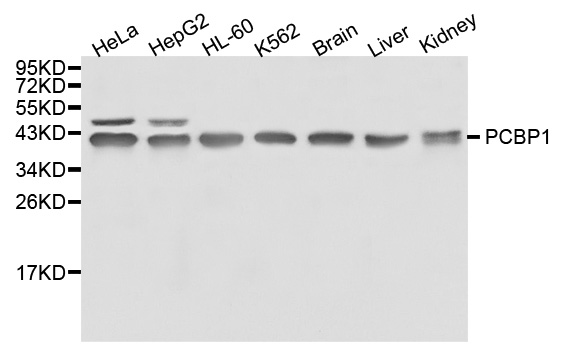 HnRNP-E1 / PCBP1 Antibody - Western blot analysis of extracts of various cell lines.