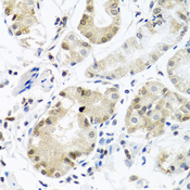 HnRNP-E1 / PCBP1 Antibody - Immunohistochemistry of paraffin-embedded human stomach using PCBP1 antibodyat dilution of 1:100 (40x lens).