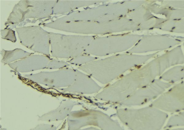 HnRNP-E1 / PCBP1 Antibody - 1:100 staining mouse muscle tissue by IHC-P. The sample was formaldehyde fixed and a heat mediated antigen retrieval step in citrate buffer was performed. The sample was then blocked and incubated with the antibody for 1.5 hours at 22°C. An HRP conjugated goat anti-rabbit antibody was used as the secondary.