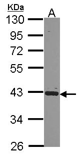HNRNP-E2 / PCBP2 Antibody - Sample (30 ug of whole cell lysate). A: Raji. 10% SDS PAGE. HNRNP-E2 / PCBP2 antibody diluted at 1:1000.