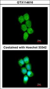 HNRNP-E2 / PCBP2 Antibody - Immunofluorescence of methanol-fixed A431 using PCBP2 antibody at 1:200 dilution.