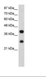 HNRNP-E2 / PCBP2 Antibody - Jurkat Cell Lysate.  This image was taken for the unconjugated form of this product. Other forms have not been tested.