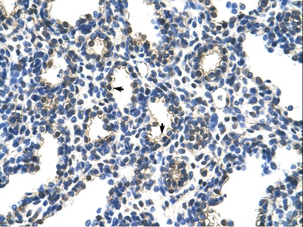 HNRNP-E2 / PCBP2 Antibody - PCBP2 antibody ARP40568_T100-NP_005007-PCBP2 (poly(rC) binding protein 2) Antibody was used in IHC to stain formalin-fixed, paraffin-embedded human lung.  This image was taken for the unconjugated form of this product. Other forms have not been tested.