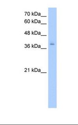 HNRNP-E2 / PCBP2 Antibody - HepG2 cell lysate. Antibody concentration: 2.5 ug/ml. Gel concentration: 12%.  This image was taken for the unconjugated form of this product. Other forms have not been tested.