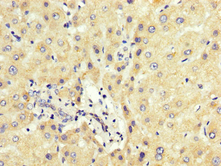 HNRNP-E2 / PCBP2 Antibody - Immunohistochemistry image at a dilution of 1:200 and staining in paraffin-embedded human liver tissue performed on a Leica BondTM system. After dewaxing and hydration, antigen retrieval was mediated by high pressure in a citrate buffer (pH 6.0) . Section was blocked with 10% normal goat serum 30min at RT. Then primary antibody (1% BSA) was incubated at 4 °C overnight. The primary is detected by a biotinylated secondary antibody and visualized using an HRP conjugated SP system.