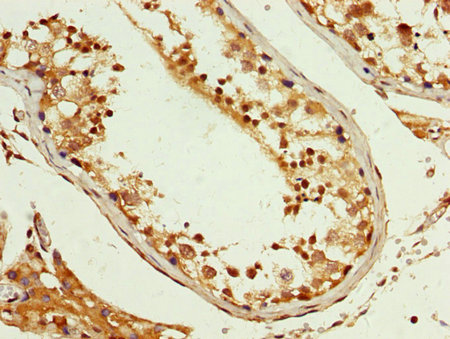 HNRNP-E2 / PCBP2 Antibody - Immunohistochemistry image at a dilution of 1:200 and staining in paraffin-embedded human testis tissue performed on a Leica BondTM system. After dewaxing and hydration, antigen retrieval was mediated by high pressure in a citrate buffer (pH 6.0) . Section was blocked with 10% normal goat serum 30min at RT. Then primary antibody (1% BSA) was incubated at 4 °C overnight. The primary is detected by a biotinylated secondary antibody and visualized using an HRP conjugated SP system.