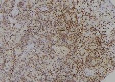 HNRNP-E2 / PCBP2 Antibody - 1:100 staining rat spleen tissue by IHC-P. The sample was formaldehyde fixed and a heat mediated antigen retrieval step in citrate buffer was performed. The sample was then blocked and incubated with the antibody for 1.5 hours at 22°C. An HRP conjugated goat anti-rabbit antibody was used as the secondary.