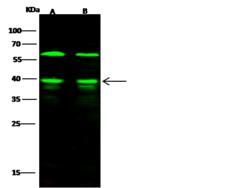 HNRNP-E2 / PCBP2 Antibody - Anti-PCBP2 rabbit polyclonal antibody at 1:500 dilution. Lane A: K562 Whole Cell Lysate. Lane B: Jurkat Whole Cell Lysate. Lysates/proteins at 30 ug per lane. Secondary: Goat Anti-Rabbit IgG H&L (Dylight 800) at 1/10000 dilution. Developed using the Odyssey technique. Performed under reducing conditions. Predicted band size: 39 kDa. Observed band size: 39 kDa. (We are unsure as to the identity of these extra bands.)