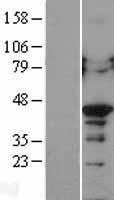 HNRNP-E2 / PCBP2 Protein - Western validation with an anti-DDK antibody * L: Control HEK293 lysate R: Over-expression lysate