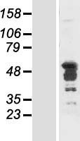 HNRNP-E2 / PCBP2 Protein - Western validation with an anti-DDK antibody * L: Control HEK293 lysate R: Over-expression lysate