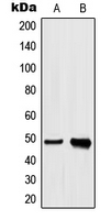 hnRNP H1+H2 Antibody - Western blot analysis of hnRNP H expression in A549 (A); HeLa (B) whole cell lysates.