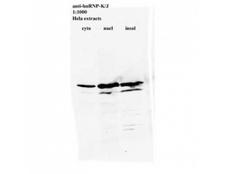 hnRNP K + J Antibody - Western blot of HNRNPK/J antibody.