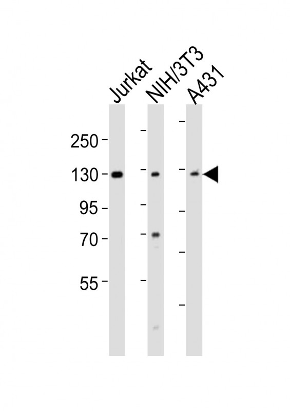 HnRNP U Antibody - All lanes : Anti-HNRNPU Antibody at 1:2000 dilution Lane 1: Jurkat whole cell lysates Lane 2: NIH/3T3 whole cell lysates Lane 3: A431 whole cell lysates Lysates/proteins at 20 ug per lane. Secondary Goat Anti-Rabbit IgG, (H+L), Peroxidase conjugated at 1/10000 dilution Predicted band size : 91 kDa Blocking/Dilution buffer: 5% NFDM/TBST.