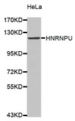 HnRNP U Antibody - Western blot analysis of extracts of HeLa cellss.