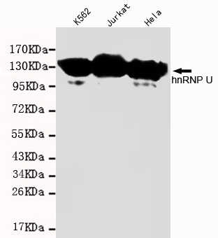 HnRNP U Antibody - Western blot detection of hnRNP U in K562, Jurkat and HeLa cell lysates and using hnRNP U mouse monoclonal antibody(1:1000 dilution). Predicted band size: 110KDa. Observed band size: 110KDa.