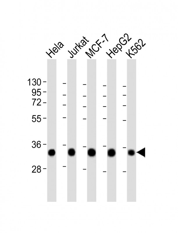 HNRNPA1L2 Antibody - All lanes: Anti-HNRNPA1L2 Antibody (N-Term) at 1:2000 dilution. Lane 1: HeLa whole cell lysate. Lane 2: Jurkat whole cell lysate. Lane 3: MCF-7 whole cell lysate. Lane 4: HepG2 whole cell lysate. Lane 5: K562 whole cell lysate Lysates/proteins at 20 ug per lane. Secondary Goat Anti-Rabbit IgG, (H+L), Peroxidase conjugated at 1:10000 dilution. Predicted band size: 34 kDa. Blocking/Dilution buffer: 5% NFDM/TBST.