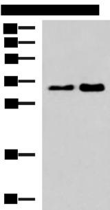 HNRNPA1L2 Antibody - Western blot analysis of 293T cell lysates  using HNRNPA1L2 Polyclonal Antibody at dilution of 1:500