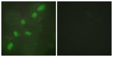 HNRNPA2B1 Antibody - Immunofluorescence analysis of HeLa cells, using hnRNP A2/B1 Antibody. The picture on the right is blocked with the synthesized peptide.
