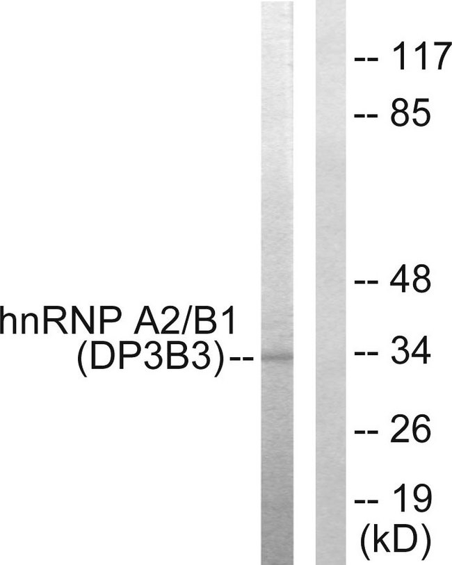 HNRNPA2B1 Antibody - Western blot analysis of lysates from HepG2 cells, using hnRNP A2/B1 Antibody. The lane on the right is blocked with the synthesized peptide.