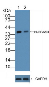 HNRNPA2B1 Antibody - Knockout Varification: Lane 1: Wild-type A549 cell lysate; Lane 2: HNRPA2B1 knockout A549 cell lysate; Predicted MW: 37kd Observed MW: 37kd Primary Ab: 5µg/ml Rabbit Anti-Human HNRPA2B1 Antibody Second Ab: 0.2µg/mL HRP-Linked Caprine Anti-Rabbit IgG Polyclonal Antibody