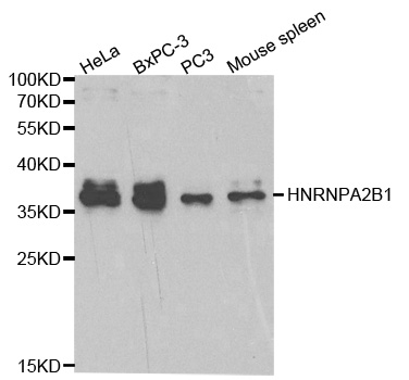 HNRNPA2B1 Antibody - Western blot analysis of extracts of various cell lines.