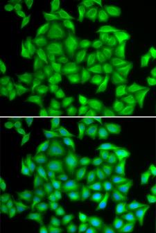 HNRNPA2B1 Antibody - Immunofluorescence analysis of A549 cells.
