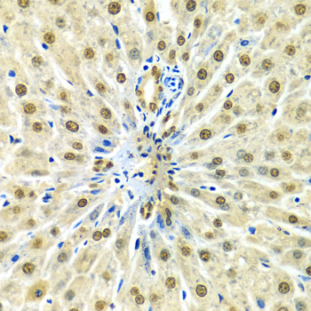 HNRNPA2B1 Antibody - Immunohistochemistry of paraffin-embedded rat liver using HNRNPA2B1 Antibodyat dilution of 1:100 (40x lens).