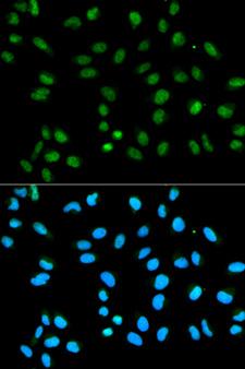 HNRNPA2B1 Antibody - Immunofluorescence analysis of HeLa cells using HNRNPA2B1 antibody. Blue: DAPI for nuclear staining.