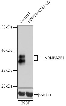 HNRNPA2B1 Antibody - Western blot analysis of extracts from normal (control) and HNRNPA2B1 knockout (KO) 293T cells, using HNRNPA2B1 antibodyat 1:1000 dilution. The secondary antibody used was an HRP Goat Anti-Rabbit IgG (H+L) at 1:10000 dilution. Lysates were loaded 25ug per lane and 3% nonfat dry milk in TBST was used for blocking. An ECL Kit was used for detection and the exposure time was 1s.