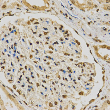 HNRNPA2B1 Antibody - Immunohistochemistry of paraffin-embedded human kidney using HNRNPA2B1 Antibodyat dilution of 1:200 (40x lens).