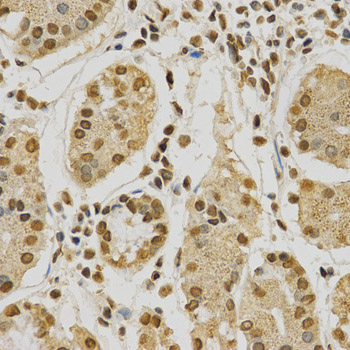 HNRNPA2B1 Antibody - Immunohistochemistry of paraffin-embedded human stomach using HNRNPA2B1 Antibodyat dilution of 1:200 (40x lens).