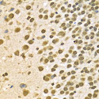 HNRNPA2B1 Antibody - Immunohistochemistry of paraffin-embedded mouse brain using HNRNPA2B1 Antibodyat dilution of 1:100 (40x lens).