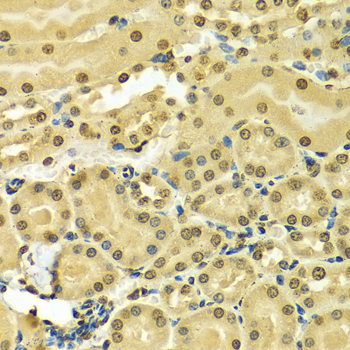 HNRNPA2B1 Antibody - Immunohistochemistry of paraffin-embedded mouse kidney using HNRNPA2B1 Antibodyat dilution of 1:100 (40x lens).