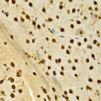 HNRNPA2B1 Antibody - Immunohistochemistry of paraffin-embedded rat brain using HNRNPA2B1 Antibodyat dilution of 1:100 (40x lens).