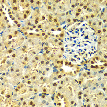 HNRNPA2B1 Antibody - Immunohistochemistry of paraffin-embedded rat kidney using HNRNPA2B1 Antibodyat dilution of 1:100 (40x lens).